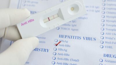 Hepatitis C: Causes, symptoms and treatment