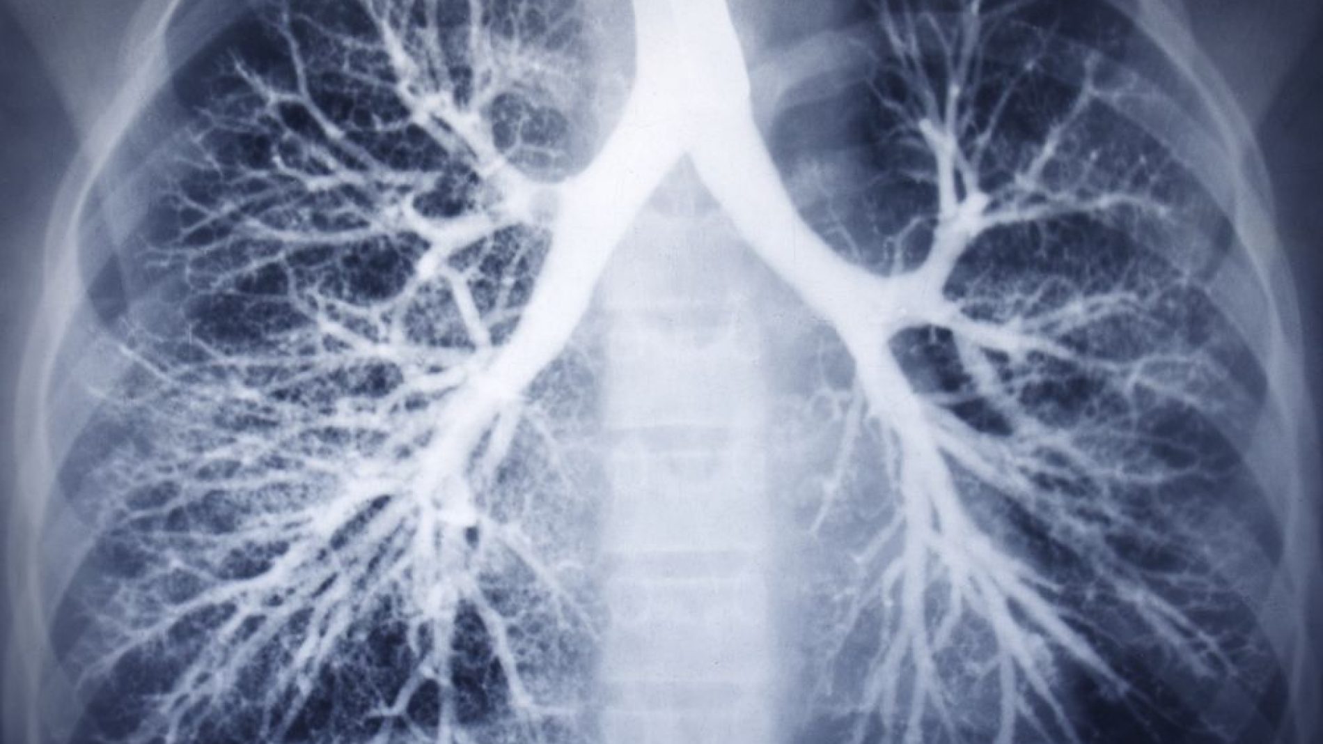 Lungs