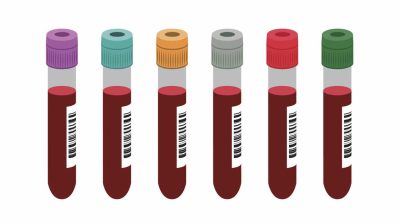 Vector image of various blood test tubes